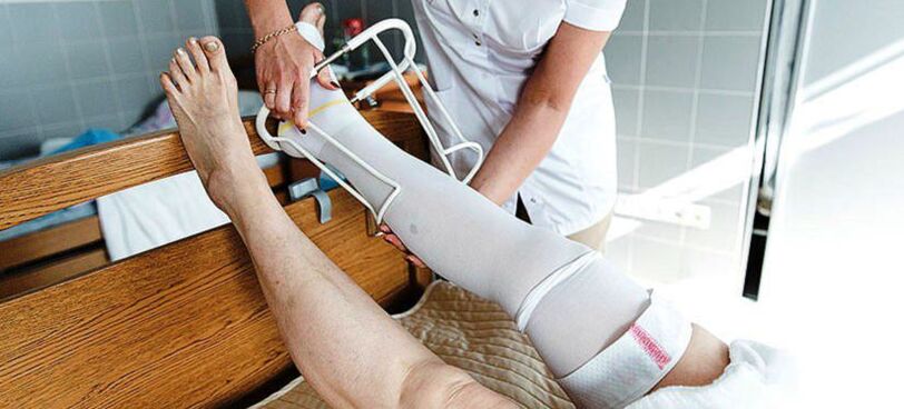 bas de contention pour le traitement des varices